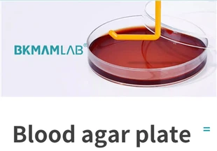 Cultuurmedium Gebruiksklare bloedagarplaten (9 cm) Gebruikt voor isolatiecultuur en hemolysetest van algemene bacteriën